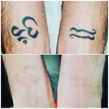 non-surgical methods - laser tattoo removal